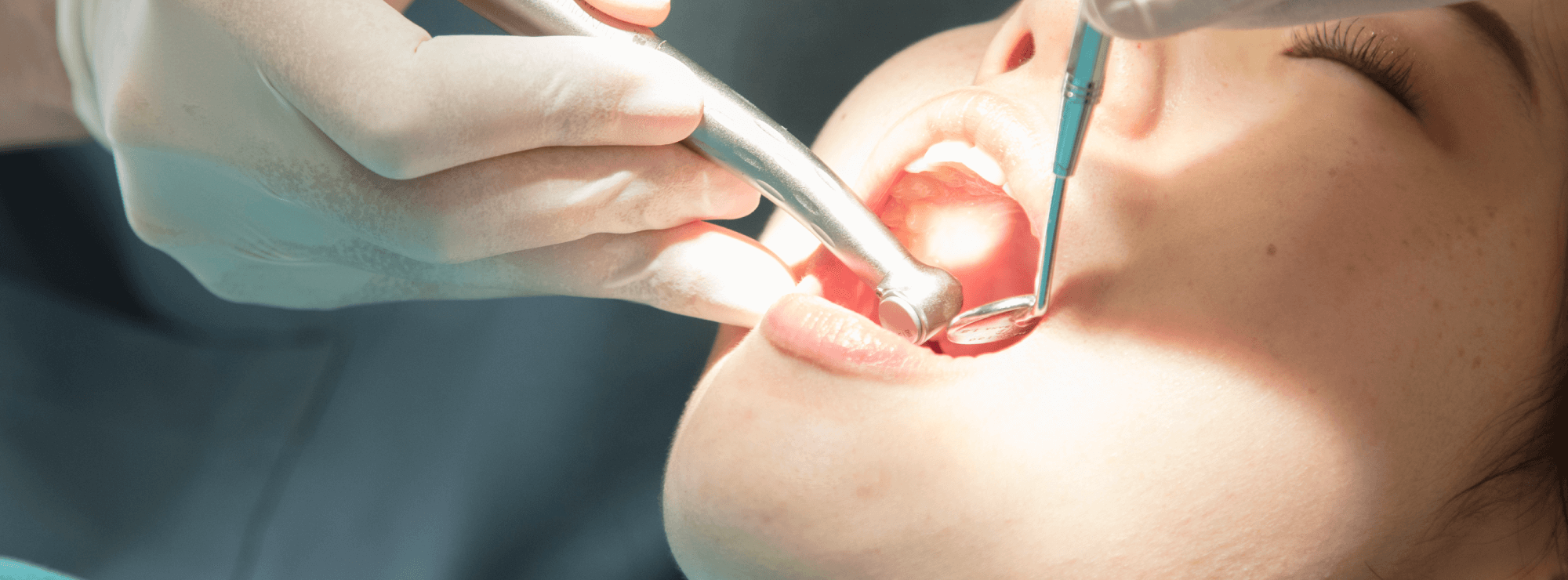 つばき歯科の治療方針